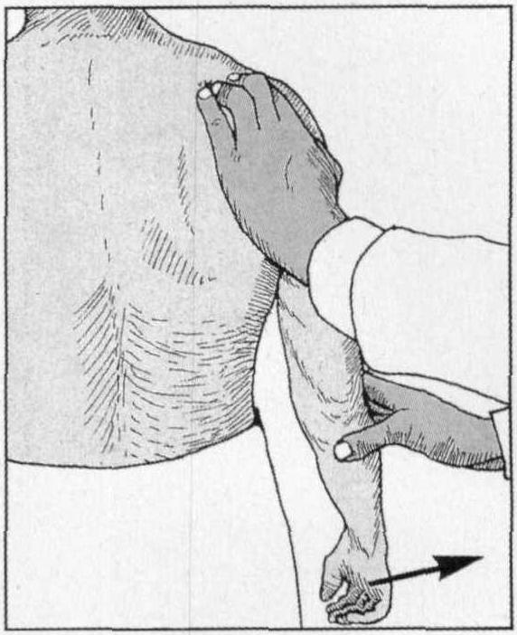 四、臂叢神經(jīng)損傷的評(píng)價(jià)